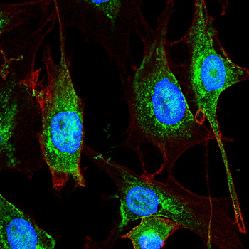 PPIB Antibody