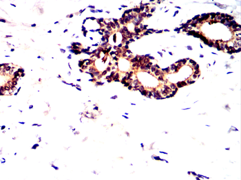 TFRC Antibody