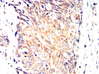 TFRC Antibody