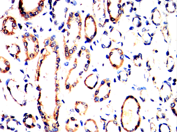 CXCL10 Antibody