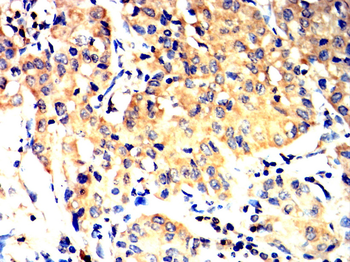 CXCL10 Antibody