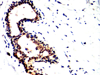TARDBP Antibody