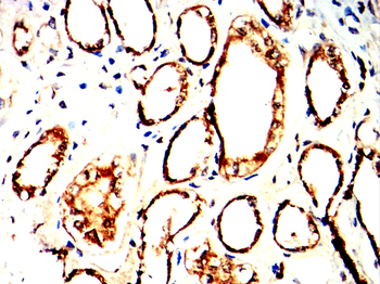 TARDBP Antibody