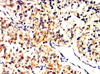 TARDBP Antibody