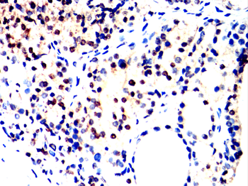 TARDBP Antibody