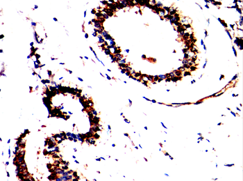 CDK5 Antibody