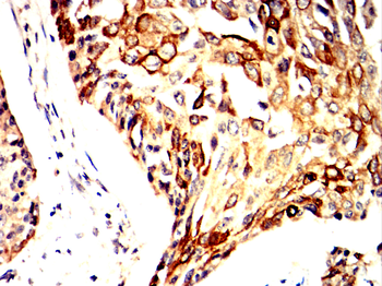 CDK5 Antibody