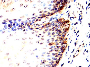 CDK5 Antibody