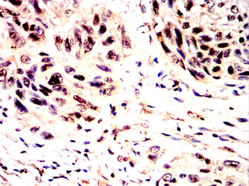 ARPC5 Antibody