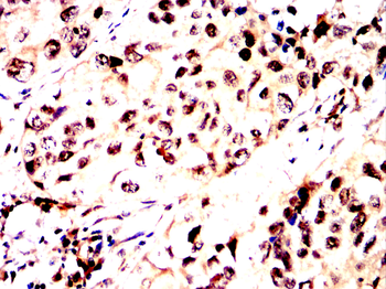ARPC5 Antibody