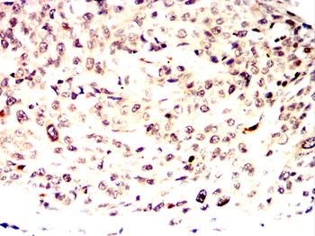 ARPC5 Antibody