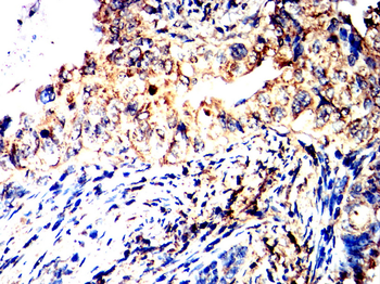 MME Antibody