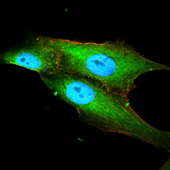 CDKN1B Antibody