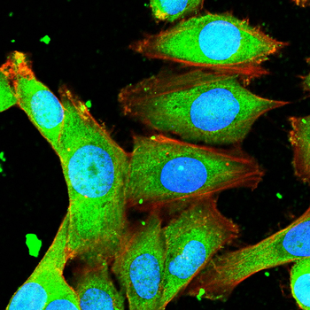 CDKN1B Antibody