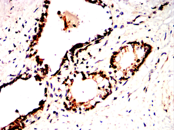 CDK2 Antibody