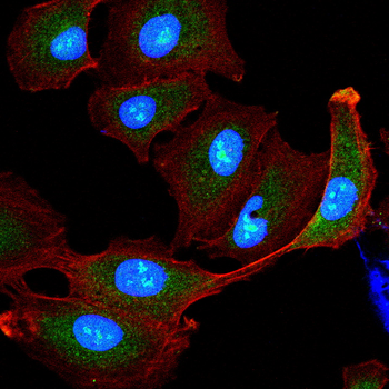 KRT17 Antibody