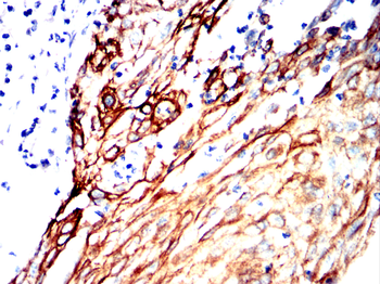KRT17 Antibody