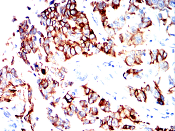KRT17 Antibody