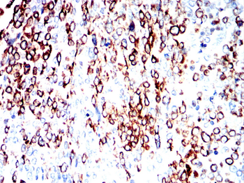 KRT17 Antibody