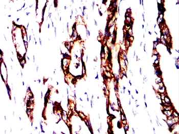 KRT17 Antibody