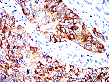KRT17 Antibody