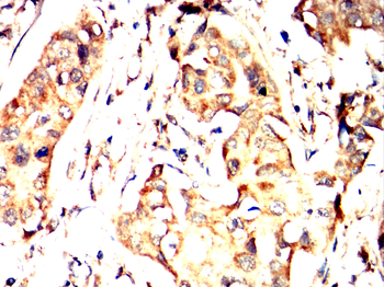 FBXO32 Antibody