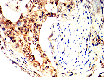 FBXO32 Antibody