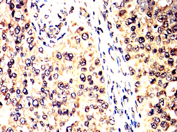 FBXO32 Antibody