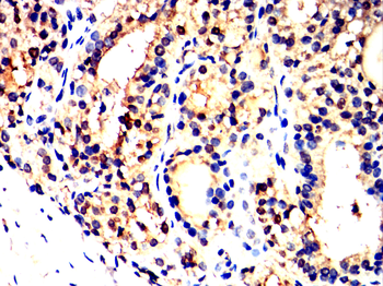 FBXO32 Antibody