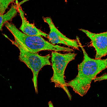 LGALS1 Antibody