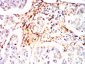 LGALS1 Antibody