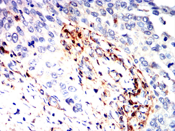 LGALS1 Antibody
