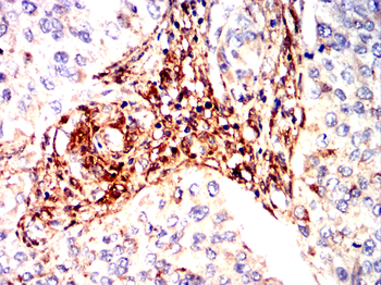 LGALS1 Antibody