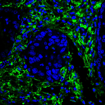 LGALS1 Antibody