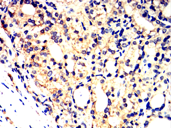 TIA1 Antibody