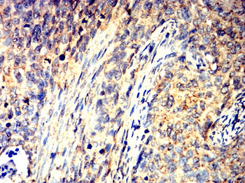 STAT3 Antibody