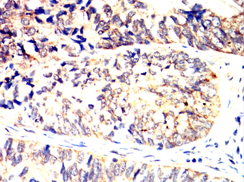 STAT3 Antibody
