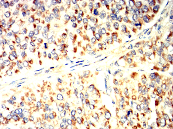 STAT3 Antibody