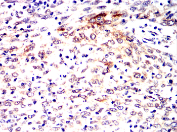 FN1 Antibody