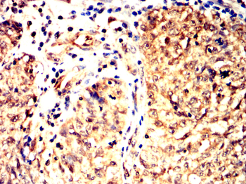 SMAD3 Antibody