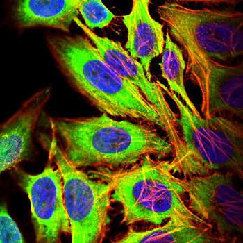 CDKN1A Antibody