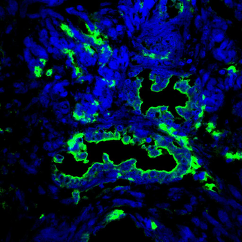 CDKN1A Antibody