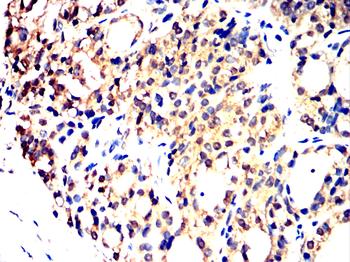 CDKN1A Antibody