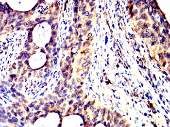 ESR1 Antibody