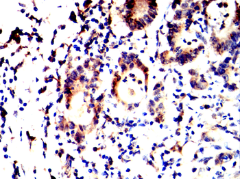 ESR1 Antibody