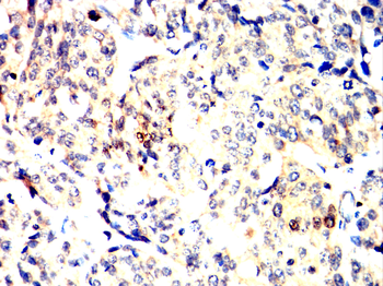 ESR1 Antibody