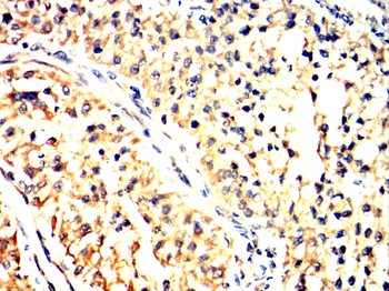 NLRP3 Antibody