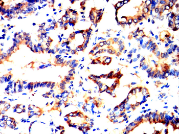 NLRP3 Antibody