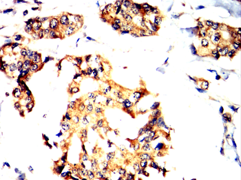 MMP3 Antibody