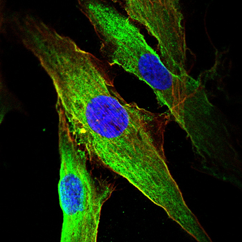 CGB3 Antibody